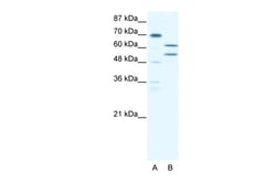 Aviva Systems Biology Corp ZNF297B Antibody - N-terminal region (ARP31799_T100)