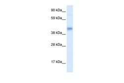 Aviva Systems Biology Corp SEC14L2 Antibody - middle region (ARP31825_P050)