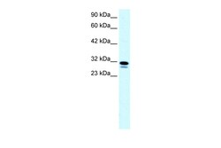 Aviva Systems Biology Corp SSBP2 Antibody - N-terminal region (ARP31828_P050)