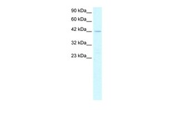 Aviva Systems Biology Corp PTF1A Antibody - N-terminal region (ARP31839_T100)