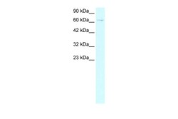 Aviva Systems Biology Corp ZBTB20 Antibody - middle region (ARP31853_T100)