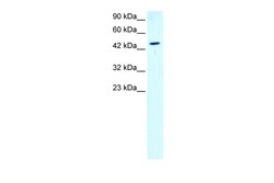 Aviva Systems Biology Corp GATA2 Antibody - N-terminal region (ARP31855_T100)