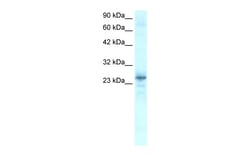 Aviva Systems Biology Corp NKX2-8 Antibody - C-terminal region (ARP31856_P050)