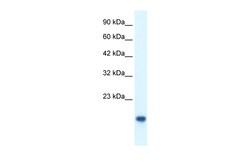 Aviva Systems Biology Corp MYCBP Antibody - middle region (ARP31860_T100)