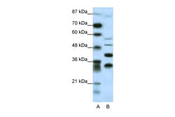 Aviva Systems Biology Corp GFI1 Antibody - N-terminal region (ARP31869_P050)