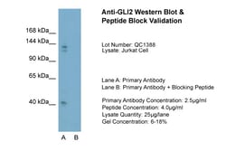 Aviva Systems Biology Corp GLI2 Antibody - middle region (ARP31885_T100)