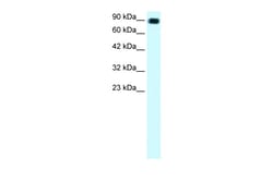Aviva Systems Biology Corp C13ORF8 Antibody - middle region (ARP31889_T100)