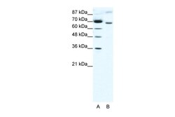 Aviva Systems Biology Corp RACGAP1 Antibody - N-terminal region (ARP31905_T100)