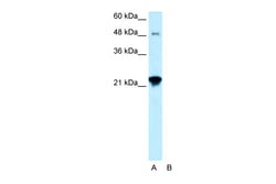 Aviva Systems Biology Corp LASS2 Antibody - N-terminal region (ARP31922_P050)