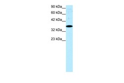 Aviva Systems Biology Corp NR4A1 Antibody - N-terminal region (ARP31941_P050)