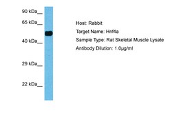 Aviva Systems Biology Corp HNF4A Antibody - N-terminal region (ARP31946_P050)