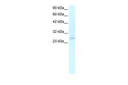 Aviva Systems Biology Corp HOXC4 Antibody - N-terminal region (ARP31957_T100)