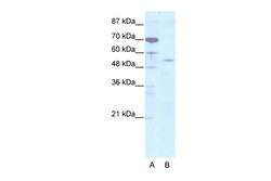 Aviva Systems Biology Corp EVX2 Antibody - N-terminal region (ARP31982_T100)