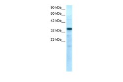 Aviva Systems Biology Corp TBX10 Antibody - N-terminal region (ARP31986_P050)