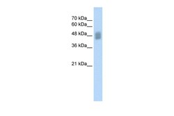 Aviva Systems Biology Corp IRF3 Antibody - C-terminal region (ARP31992_P050)