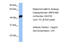 Aviva Systems Biology Corp LMX1A Antibody - middle region (ARP31999_P050)
