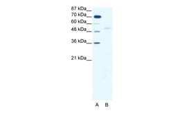 Aviva Systems Biology Corp SMAD5 Antibody - middle region (ARP32006_T100)
