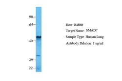 Aviva Systems Biology Corp SMAD7 Antibody - N-terminal region (ARP32008_P050)
