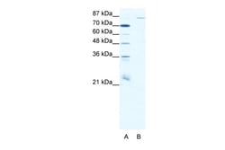 Aviva Systems Biology Corp MEFV Antibody - N-terminal region (ARP32016_T100)