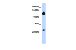 Aviva Systems Biology Corp NOTCH4 Antibody - middle region (ARP32052_P050)