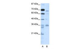Aviva Systems Biology Corp PCSK6 Antibody - N-terminal region (ARP32060_T100)
