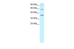 Aviva Systems Biology Corp PAWR Antibody - middle region (ARP32062_P050)