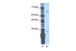 Aviva Systems Biology Corp ZNF691 Antibody - N-terminal region (ARP32076_T100)