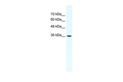 Aviva Systems Biology Corp DVL1 Antibody - middle region (ARP32100_T100)
