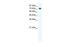 Aviva Systems Biology Corp DVL1 Antibody - C-terminal region (ARP32101_T100)