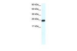 Aviva Systems Biology Corp MYF6 Antibody - N-terminal region (ARP32135_P050)
