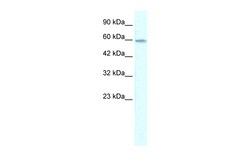 Aviva Systems Biology Corp ZNF543 Antibody - middle region (ARP32153_P050)