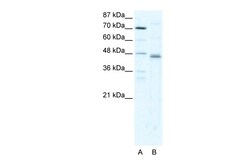 Aviva Systems Biology Corp ZFP1 Antibody - N-terminal region (ARP32194_T100)