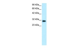 Aviva Systems Biology Corp DBP Antibody - N-terminal region (ARP32195_P050)