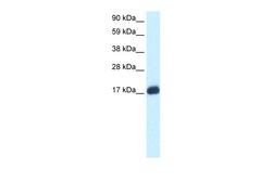 Aviva Systems Biology Corp E2F6 Antibody - middle region (ARP32221_P050)
