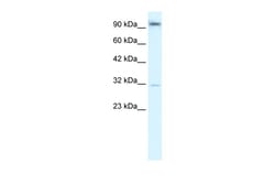 Aviva Systems Biology Corp AHR Antibody - N-terminal region (ARP32243_T100)