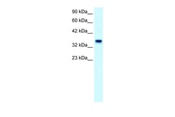 Aviva Systems Biology Corp FOXF1 Antibody - C-terminal region (ARP32296_T100)