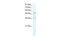 Aviva Systems Biology Corp FOXC1 Antibody - C-terminal region (ARP32300_T100)