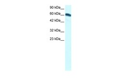 Aviva Systems Biology Corp FOXC2 Antibody - middle region (ARP32307_T100)