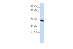 Aviva Systems Biology Corp POU1F1 Antibody - middle region (ARP32318_P050)