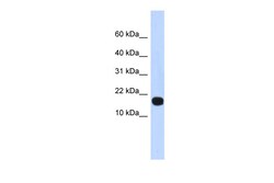 Aviva Systems Biology Corp ID4 Antibody - middle region (ARP32327_P050)