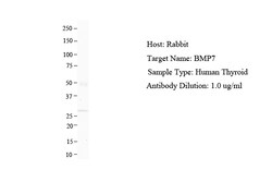 Aviva Systems Biology Corp BMP7 Antibody - N-terminal region (ARP32329_T100)