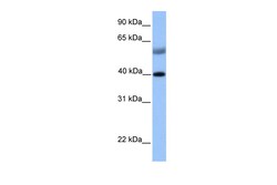 Aviva Systems Biology Corp ISL1 Antibody - N-terminal region (ARP32336_P050)