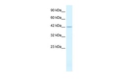 Aviva Systems Biology Corp PSMD4 Antibody - C-terminal region (ARP32341_P050)