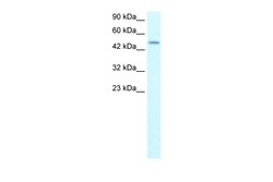 Aviva Systems Biology Corp ALX4 Antibody - N-terminal region (ARP32356_P050)