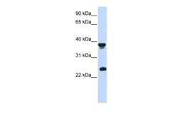 Aviva Systems Biology Corp ATOH1 Antibody - middle region (ARP32365_P050)