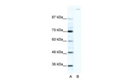 Aviva Systems Biology Corp GLI1 Antibody - C-terminal region (ARP32368_T100)