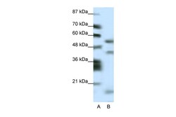 Aviva Systems Biology Corp LHX1 Antibody - N-terminal region (ARP32374_P050)