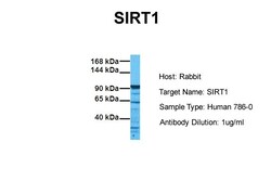 Aviva Systems Biology Corp SIRT1 Antibody - N-terminal region (ARP32386_P050)
