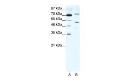Aviva Systems Biology Corp SIRT3 Antibody - middle region (ARP32388_T100)