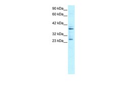 Aviva Systems Biology Corp SIRT5 Antibody - C-terminal region (ARP32390_P050)